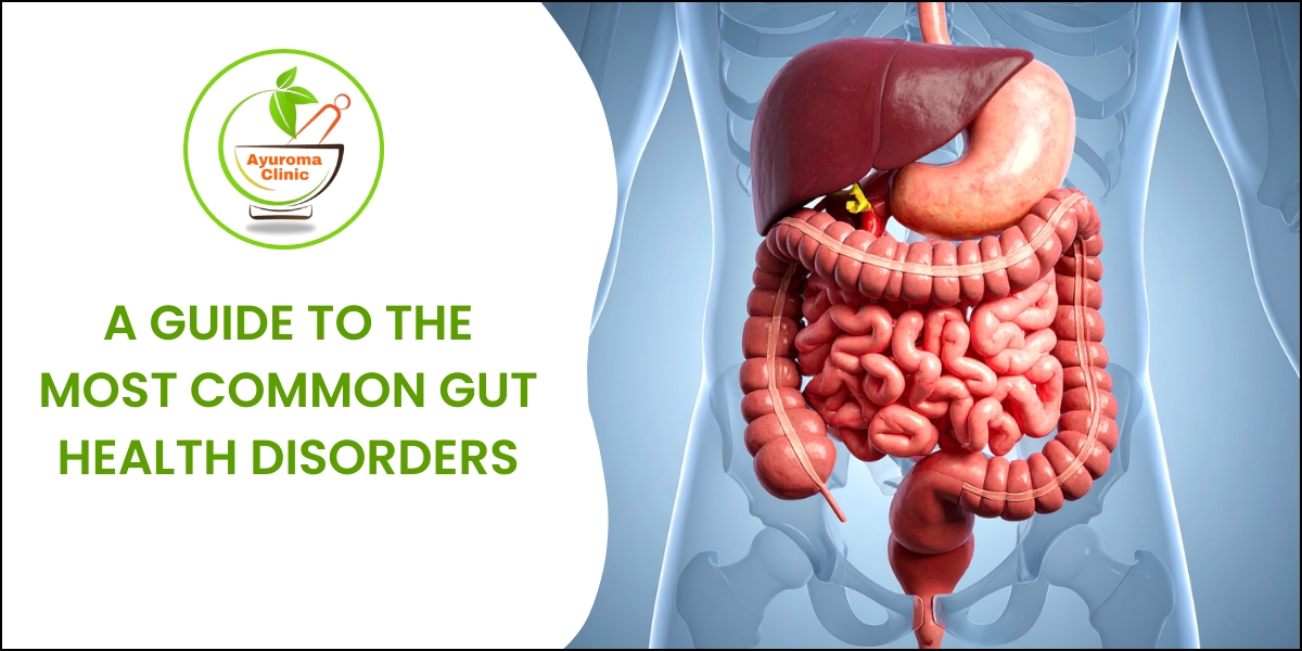 What are the most common digestive disorders?